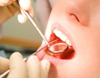 Důležitá je správná prevence. Váš zubní lékař Vám vysvětlí, jak se o zuby správně starat.